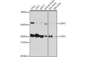 Western blot analysis of extracts of various cell lines, using CDK9 Rabbit mAb (ABIN7266597) at 1:1000 dilution. (CDK9 Antikörper)