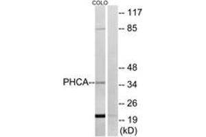 Western blot analysis of extracts from COLO cells, using PHCA Antibody. (ACER3 Antikörper  (AA 171-220))