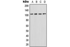 Western blot analysis of HIPK2 expression in HepG2 (A), MCF7 (B), SP2/0 (C), PC12 (D) whole cell lysates.