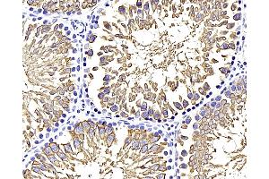 Immunohistochemistry analysis of paraffin-embedded rat testis using GLUT-3 Polyclonal Antibody at dilution of 1:400. (SLC2A3 Antikörper)