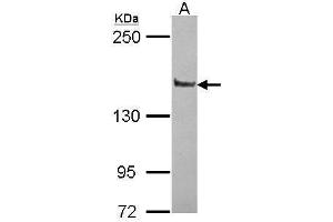 WB Image Sample (30 ug of whole cell lysate) A: JurKat 5% SDS PAGE antibody diluted at 1:10000 (PPFIA1 Antikörper  (N-Term))