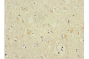 Immunohistochemistry of paraffin-embedded human brain tissue using ABIN7144207 at dilution of 1:100