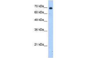 HSZFP36 antibody (20R-1274) used at 0. (ZNF823 Antikörper  (N-Term))