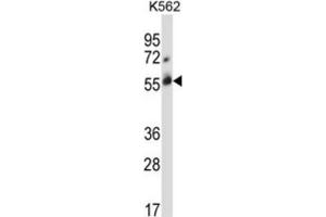 Western Blotting (WB) image for anti-Cbl proto-oncogene C (CBLC) antibody (ABIN2996838) (CBLC Antikörper)