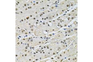 Immunohistochemistry of paraffin-embedded human stomach using H2AFZ antibody (ABIN5973977) at dilution of 1/100 (40x lens). (H2AFZ Antikörper)