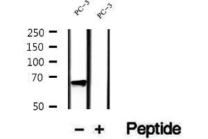 Western blot analysis of extracts of PC-3 cells, using LGTN antibody. (EIF2D Antikörper  (Internal Region))