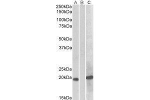 Western Blotting (WB) image for anti-Homeobox A1 (HOXA1) (Internal Region) antibody (ABIN2464864) (HOXA1 Antikörper  (Internal Region))