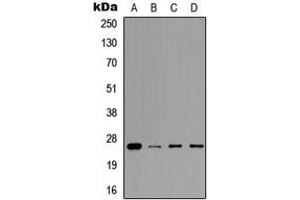 Western blot analysis of Prolactin expression in A549 (A), MCF7 (B), NS-1 (C), H9C2 (D) whole cell lysates. (Prolactin Antikörper  (Center))