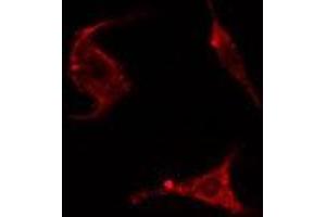 ABIN6278285 staining HepG2 cells by IF/ICC. (ENAH Antikörper  (Internal Region))