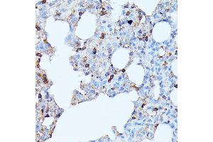 Immunohistochemistry of paraffin-embedded rat lung using CXCR1 antibody (ABIN7266317) at dilution of 1:100 (40x lens). (CXCR1 Antikörper  (AA 250-350))