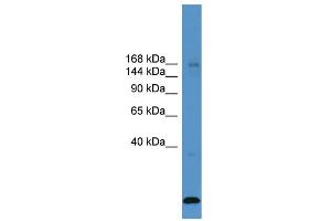 WB Suggested Anti-USP47  Antibody Titration: 0. (USP47 Antikörper  (Middle Region))
