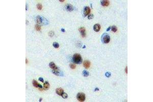 Immunohistochemical analysis of MeCP2 staining in mouse brain formalin fixed paraffin embedded tissue section. (MECP2 Antikörper)