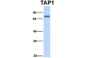Host:  Rabbit  Target Name:  TAP1  Sample Type:  Hela  Antibody Dilution:  1. (TAP1 Antikörper  (Middle Region))