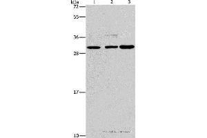 Western blot analysis of Lovo, Raji and A172 cell, using CRKL Polyclonal Antibody at dilution of 1:600 (CrkL Antikörper)