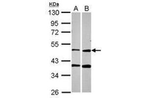 Image no. 1 for anti-Protoporphyrinogen Oxidase (PPOX) (AA 179-418) antibody (ABIN1500380) (PPOX Antikörper  (AA 179-418))