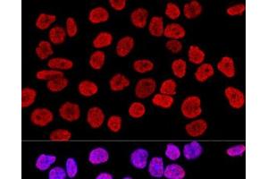 Confocal immunofluorescence analysis of HeLa cells using Histone H2AX Polyclonal Antibody at dilution of 1:400. (H2AFX Antikörper)