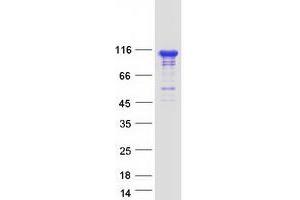 Western Blotting (WB) image for Inositol Polyphosphate-4-Phosphatase, Type II, 105kDa (INPP4B) (Transcript Variant 1) protein (Myc-DYKDDDDK Tag) (ABIN2723482)