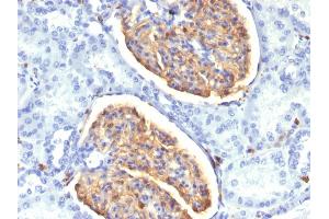 Formalin-fixed, paraffin-embedded human Kidney stained with AIF1 / Iba1 Mouse Monoclonal Antibody (AIF1/1909). (Iba1 Antikörper  (AA 1-146))