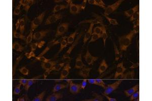 Immunofluorescence analysis of C6 cells using EIF5B Polyclonal Antibody at dilution of 1:100.