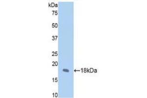 Western blot analysis of recombinant Rat FBN1. (Fibrillin 1 Antikörper  (AA 751-895))