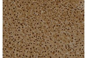 ABIN6260236 and ABIN6273993 at 1/100 staining Rat liver tissue by IHC-P. (BCL6 Antikörper  (Internal Region))