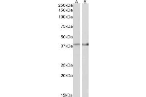 ABIN768560 (2µg/ml) staining of Mouse Heart (A) and Mouse Muscle (B) lysate (35µg protein in RIPA buffer). (IDH3B Antikörper  (AA 33-46))