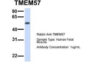 Host:  Rabbit  Target Name:  TMEM57  Sample Type:  Human Fetal Muscle  Antibody Dilution:  1. (TMEM57 Antikörper  (N-Term))