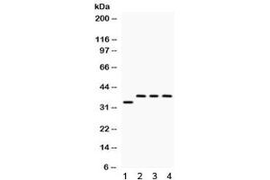 Western blot testing of 1) rat brain, 2) human SW620, 3) human 22RV1 and 4) human Hela lysate with DARPP-32 antibody. (DARPP32 Antikörper)