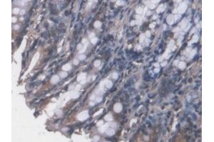IHC-P analysis of Mouse Colon Tissue, with DAB staining. (FPGT Antikörper  (AA 314-513))
