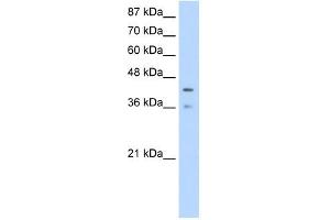 PCBP4 antibody used at 1. (PCBP4 Antikörper)