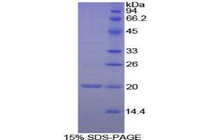 SDS-PAGE analysis of Mouse Matrix Gla Protein.