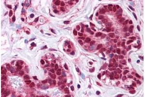 Human Breast: Formalin-Fixed, Paraffin-Embedded (FFPE) (LMBRD1 Antikörper  (C-Term))