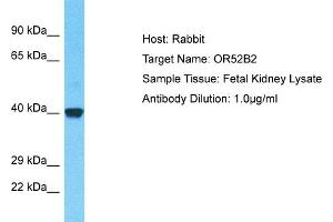 Host: Rabbit Target Name: OR52B2 Sample Type: Fetal Kidney lysates Antibody Dilution: 1. (OR52B2 Antikörper  (C-Term))