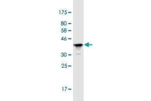 Western Blot detection against Immunogen (36. (Plakophilin 3 Antikörper  (AA 225-324))