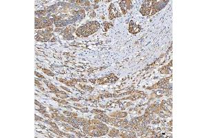 IHC analysis of TXNDC5 using anti-TXNDC5 antibody (ABIN7599699).