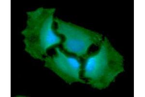 ICC/IF analysis of GPI in HeLa cells line, stained with DAPI (Blue) for nucleus staining and monoclonal anti-human GPI antibody (1:100) with goat anti-mouse IgG-Alexa fluor 488 conjugate (Green). (GPI Antikörper  (AA 1-558))