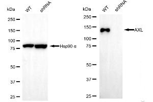 Western blotting analysis using AXL antibody (ABIN7797714).