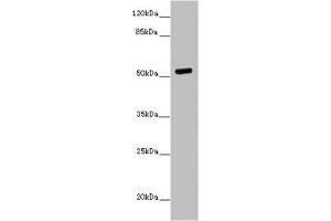 Western blot All lanes: PRMT3 antibody at 7 μg/mL + MCF-7 whole cell lysate Secondary Goat polyclonal to rabbit IgG at 1/10000 dilution Predicted band size: 60, 53 kDa Observed band size: 53 kDa (PRMT3 Antikörper  (AA 311-529))