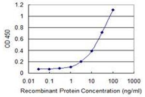 Detection limit for recombinant GST tagged SFTPC is 0. (Surfactant Protein C Antikörper  (AA 1-197))