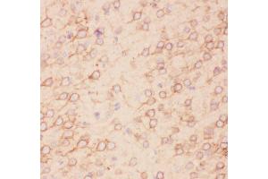 Immunohistochemistry (IHC) image for anti-Potassium Voltage-Gated Channel, Shab-Related Subfamily, Member 1 (KCNB1) (AA 687-858) antibody (ABIN3043866)