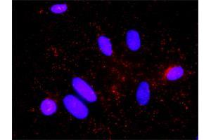 Proximity Ligation Assay (PLA) image for anti-Cyclin-Dependent Kinase Inhibitor 1B (p27, Kip1) (CDKN1B) (AA 1-198) antibody (ABIN4888951)
