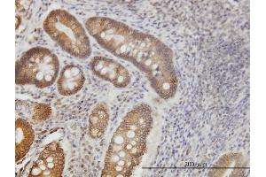 Immunostaining (ISt) image for anti-Natriuretic Peptide Receptor B/guanylate Cyclase B (Atrionatriuretic Peptide Receptor B) (NPR2) (AA 131-230) antibody (ABIN562038)