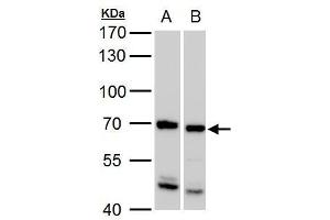 WB Image ADIP antibody [C3], C-term detects ADIP protein by western blot analysis. (SSX2IP Antikörper  (C-Term))