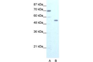 Western Blotting (WB) image for anti-Zinc Finger Protein 665 (ZNF665) antibody (ABIN2461273) (ZNF665 Antikörper)