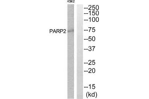 Western Blotting (WB) image for anti-Poly (ADP-Ribose) Polymerase 2 (PARP2) (Internal Region) antibody (ABIN1850490) (PARP2 Antikörper  (Internal Region))
