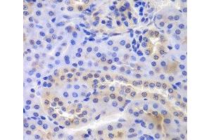 Immunohistochemistry of paraffin-embedded Mouse kidney using PSMA6 Polyclonal Antibody at dilution of 1:100 (40x lens). (PSMA6 Antikörper)