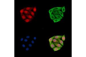 ABIN7096723 and ABIN7100788 staining Hela cells by IF/ICC. (EXOSC6 Antikörper)