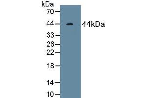 Detection of Recombinant ACVR2A, Human using Monoclonal Antibody to Activin A Receptor Type II A (ACVR2A)