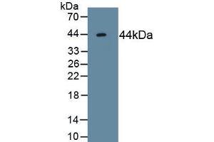 Detection of Recombinant ACVR2A, Human using Monoclonal Antibody to Activin A Receptor Type II A (ACVR2A) (ACVR2A Antikörper  (AA 20-135))