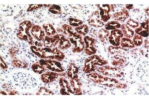 Immunohistochemistry of paraffin-embedded Human kidney tissue using CST3 Monoclonal Antibody at dilution of 1:200. (CST3 Antikörper)